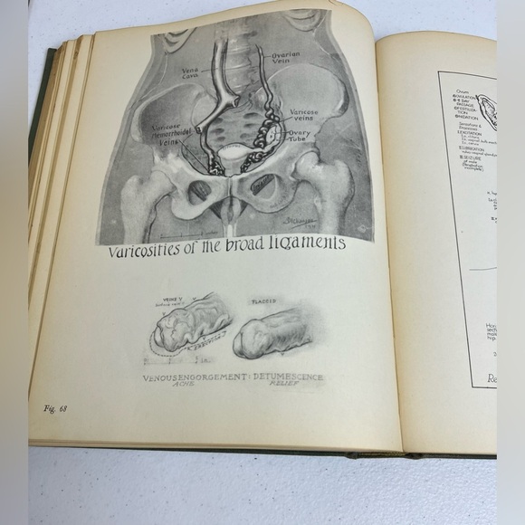 Topographical Hand Atlas Human Sex Anatomy Dickinson 1933 1st Ed Illustrated - Picture 12 of 15